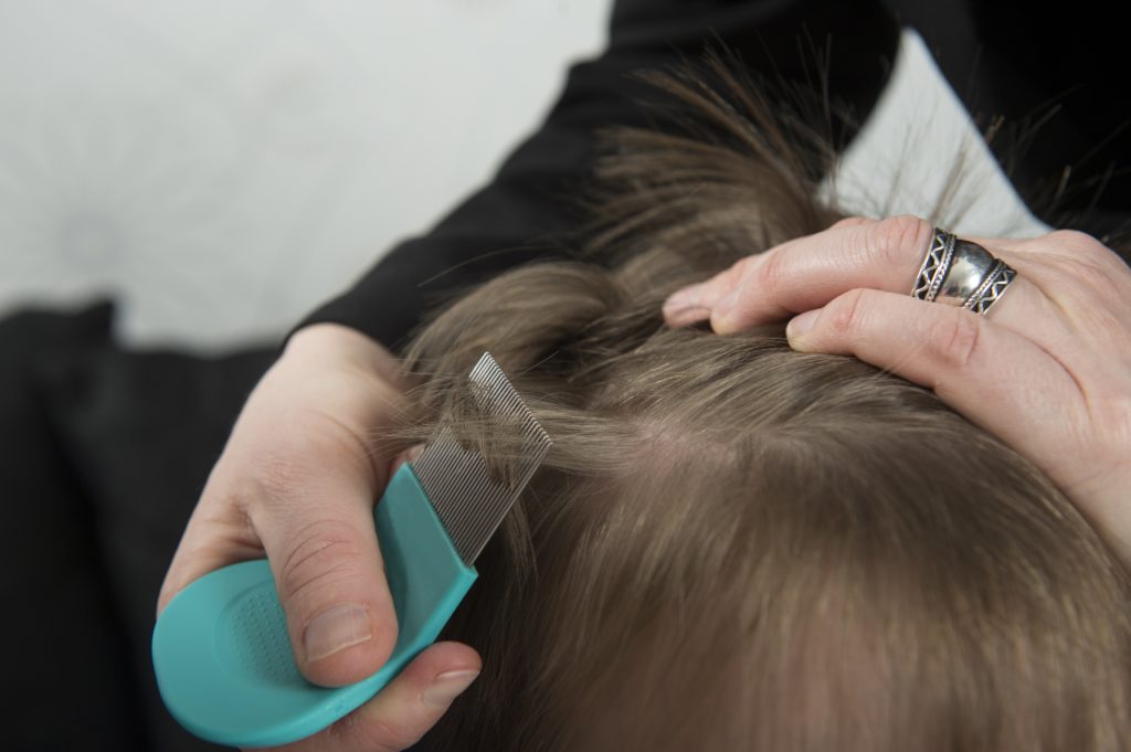 Learn How To Treat And Prevent Head Lice Ehealth Connection