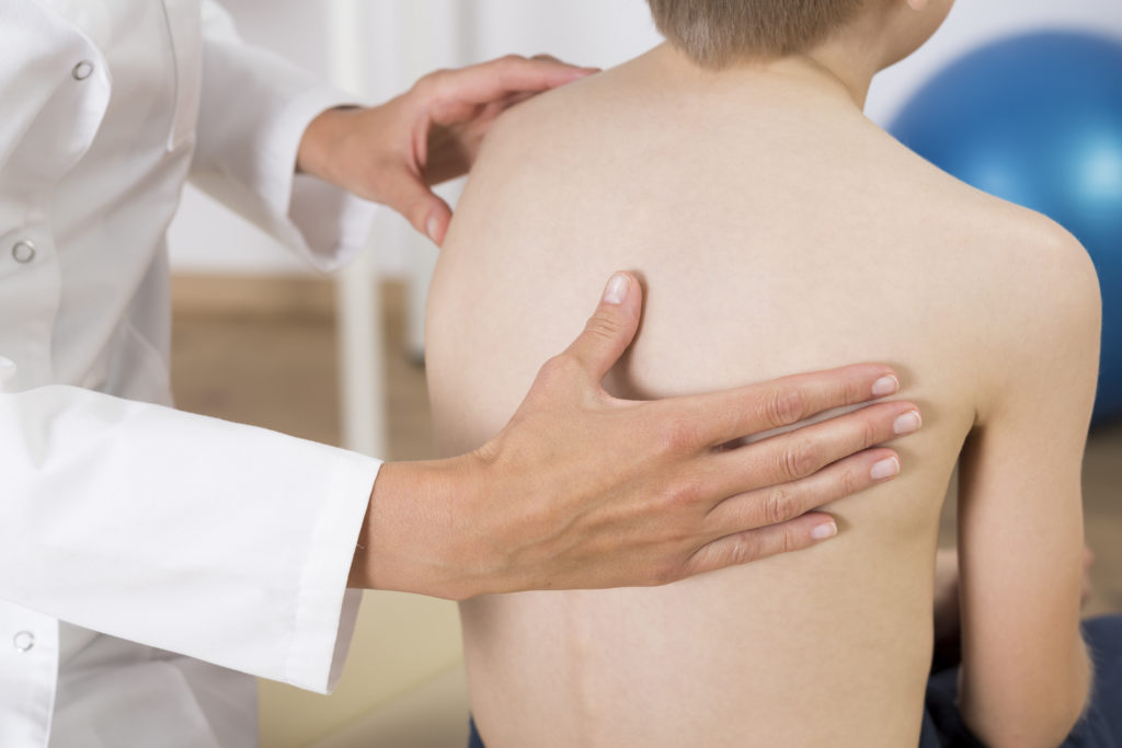 What Are the Causes of Scoliosis Prevention in Children