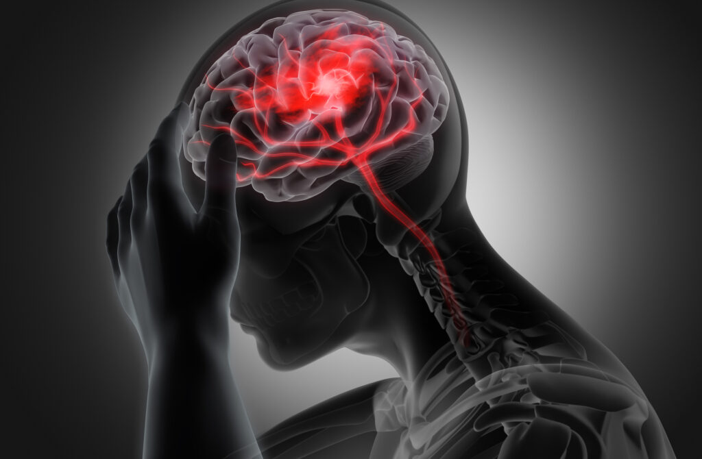 Be Smart About Traumatic Brain Injuries