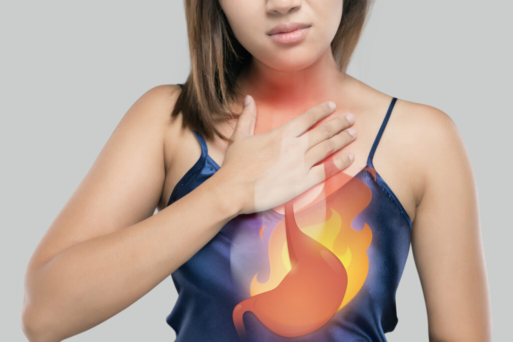 When Heartburn Is More Than Just Heartburn