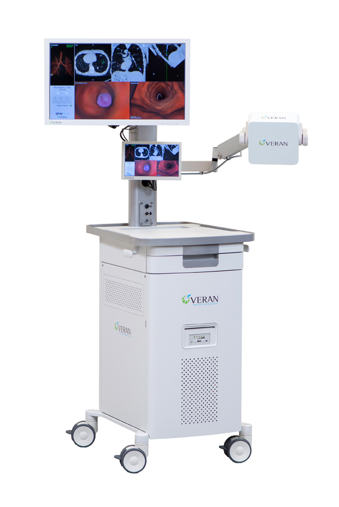 New SPiNView Navigational Bronchoscopy Aids in Early Diagnosis of Lung
